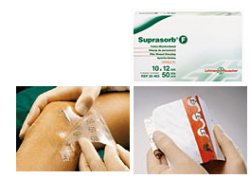 MEDICAZIONE STERILE IN FILM IN POLIURETANO TRASP. SUPRASORB F 10X12CM 10 PEZZI - farmasorriso.com